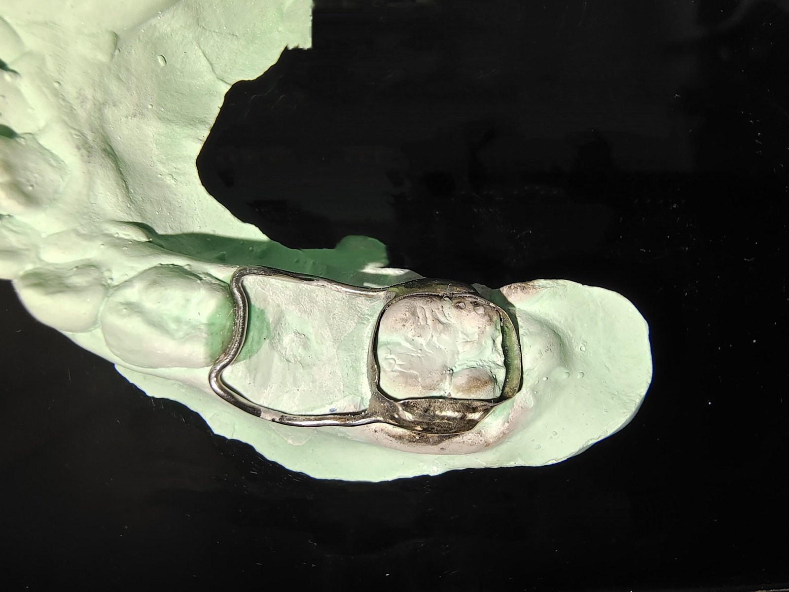 Space MAintainer on cast