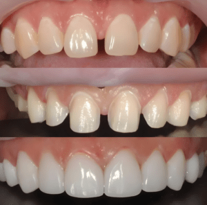 cosmetic dentistry in Kolkata