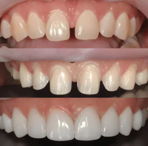 cosmetic dentistry in Kolkata