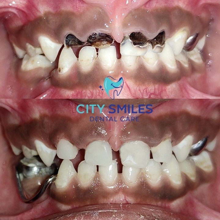 Pedo full mouth New Edited