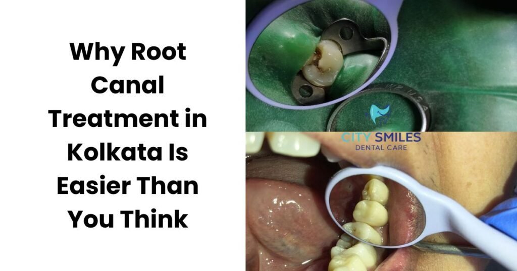 Root Canal Treatment in Kolkata