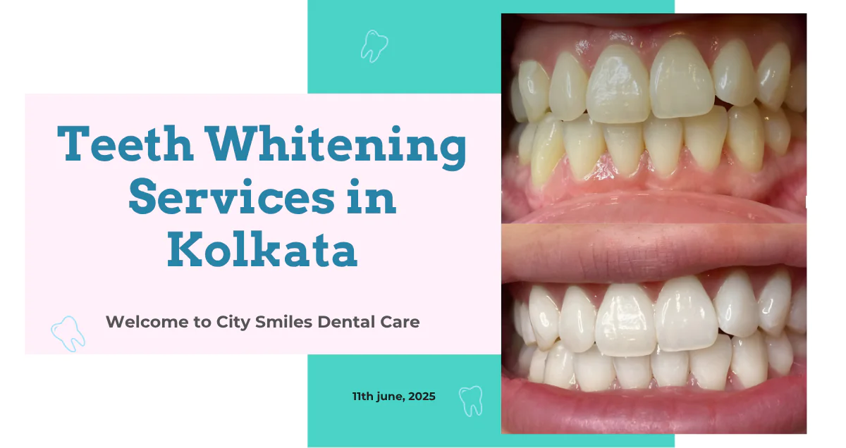 Trusted Pediatric Dentist in Kolkata