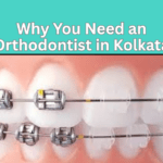 Thinking About Braces? Here’s Why You Need an Orthodontist in Kolkata