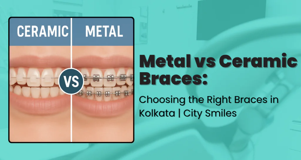 Metal vs Ceramic Braces
