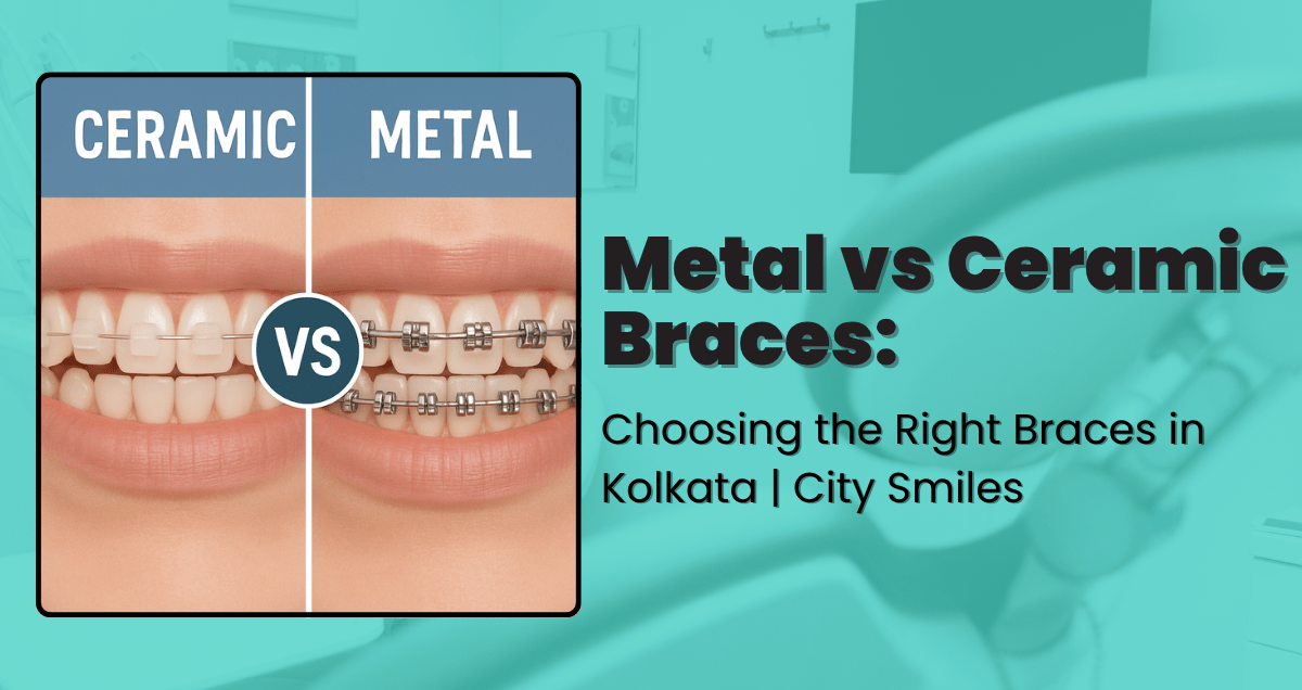 Metal vs Ceramic Braces