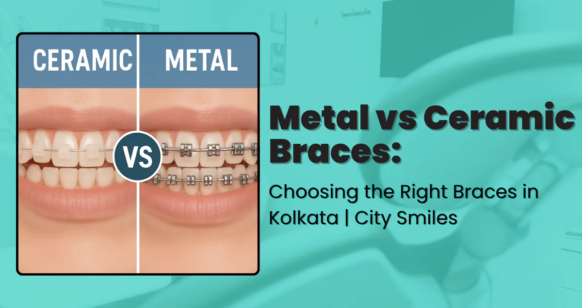 Metal vs Ceramic Braces