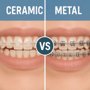 Metal vs Ceramic Braces
