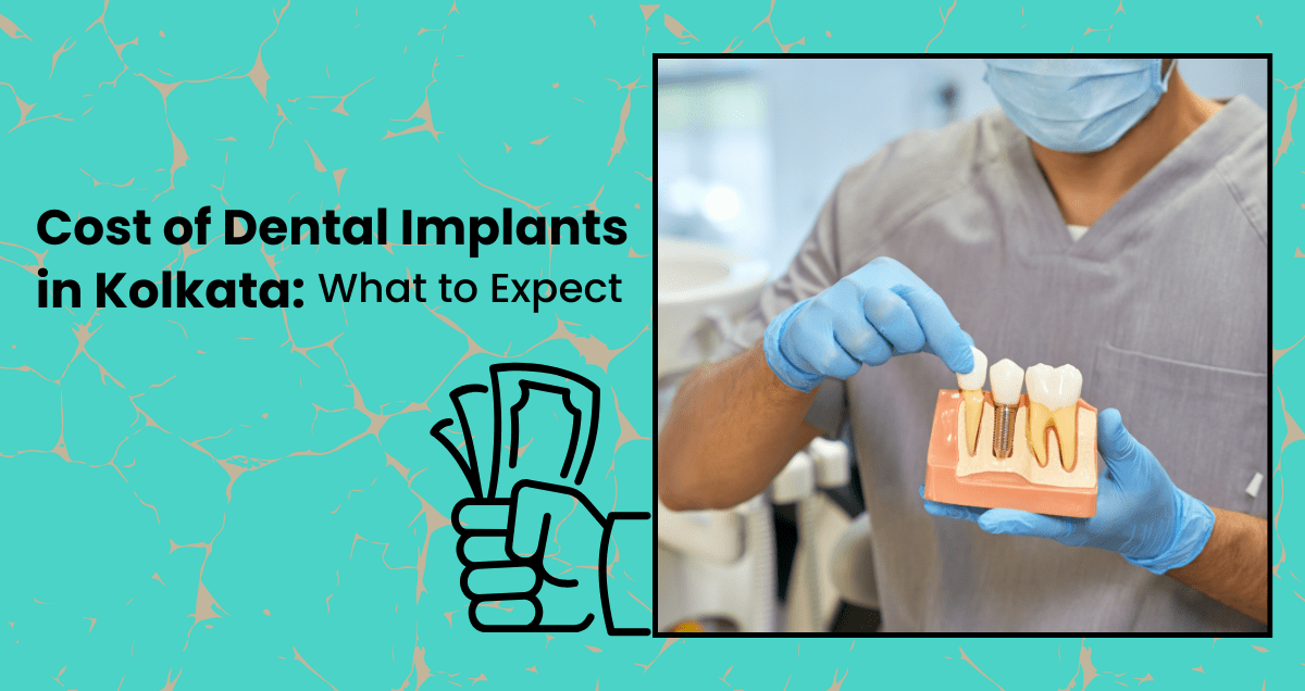 Cost of Dental Implants in Kolkata