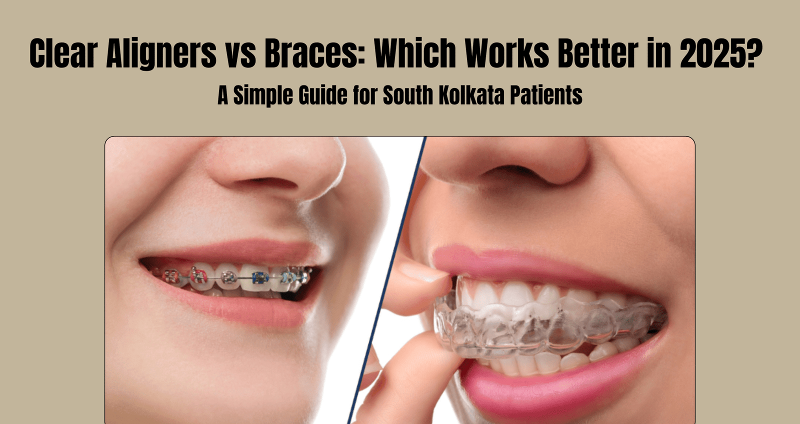 clear aligners vs braces