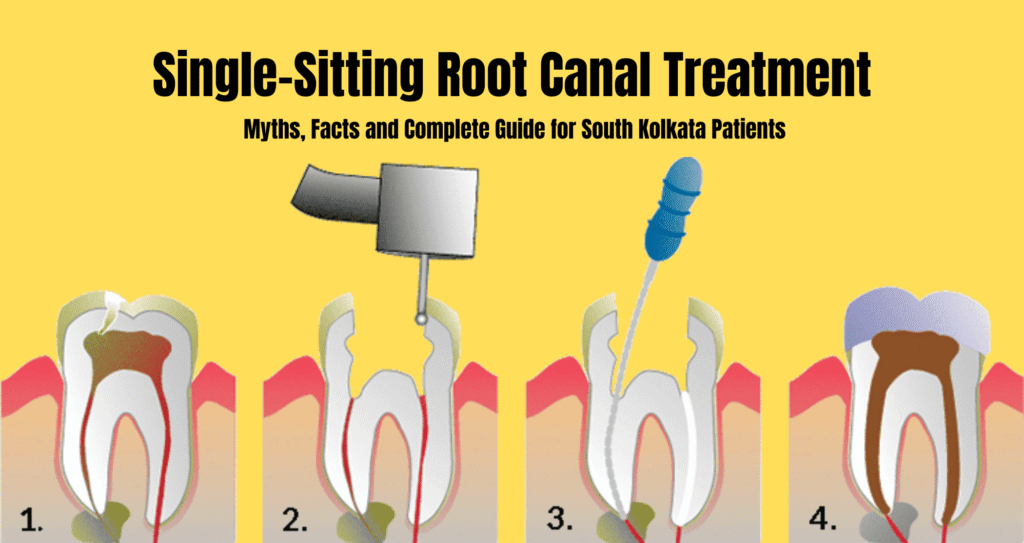single sitting root canal in South Kolkata