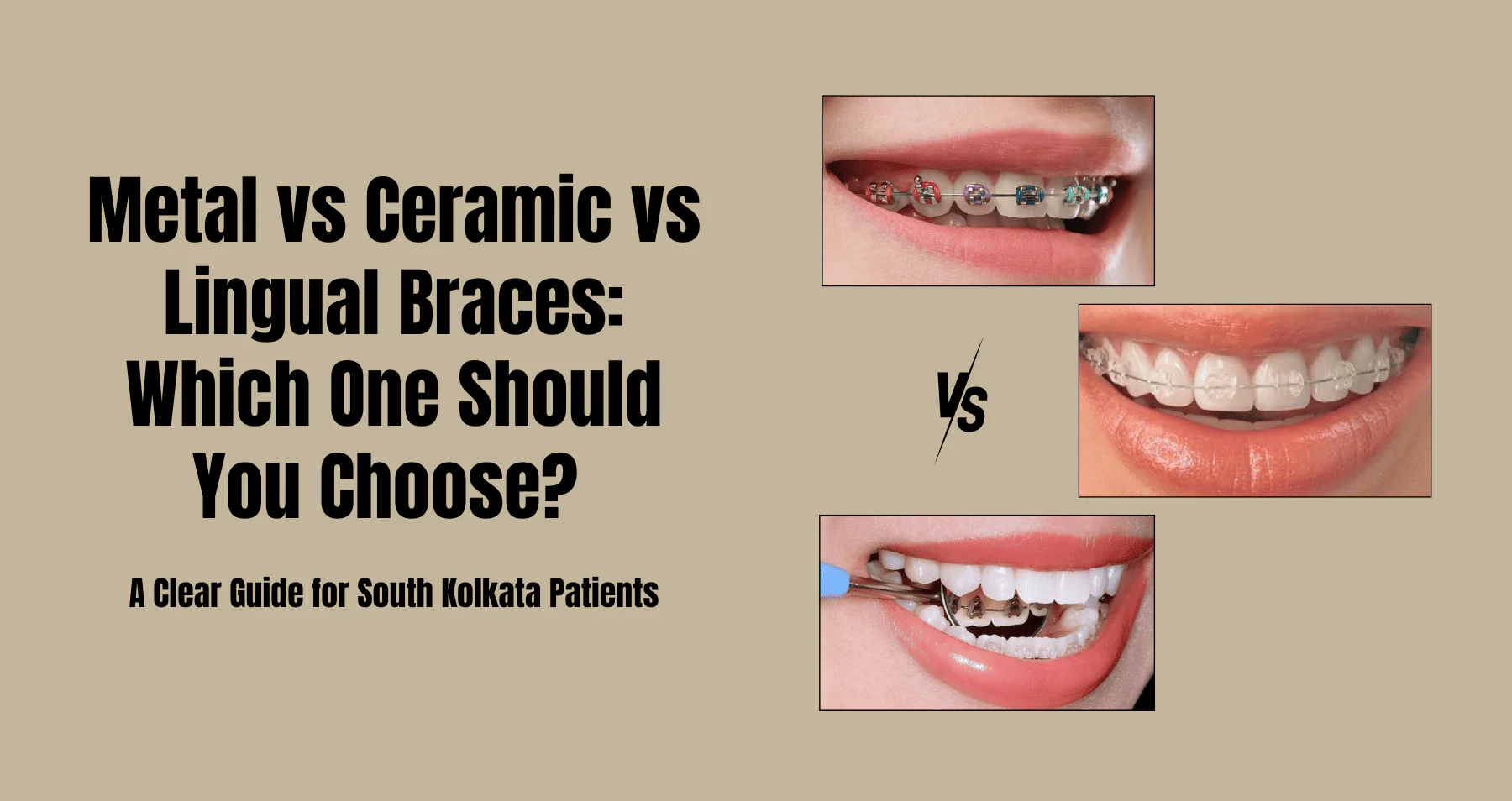 braces treatment in South Kolkata