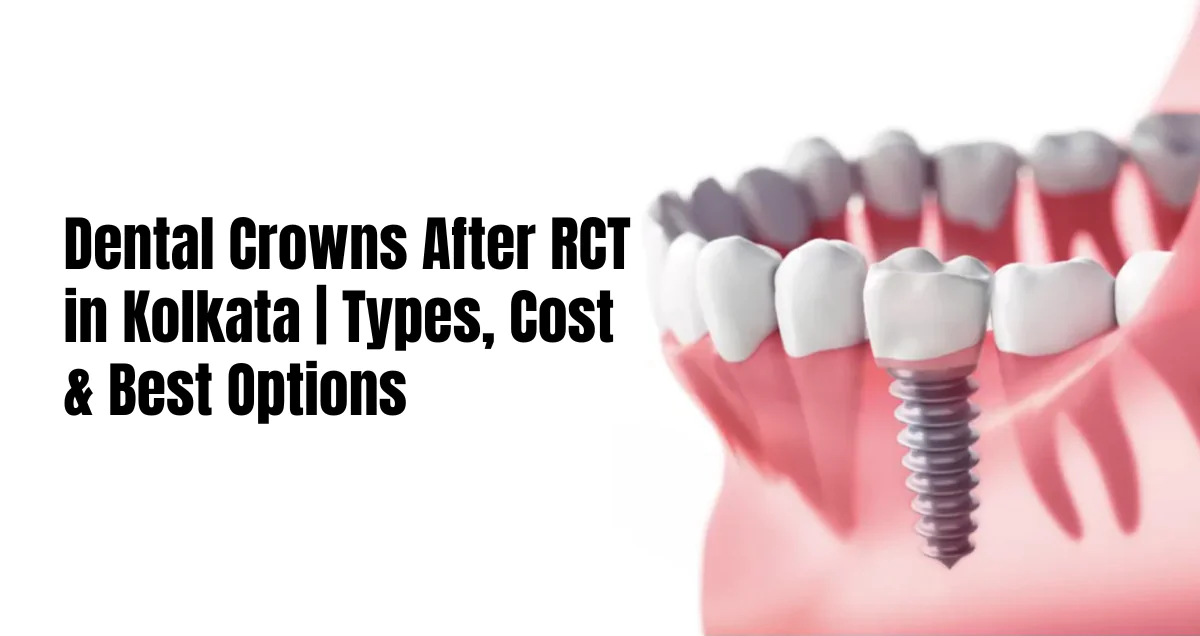 dental crowns after rct in kolkata