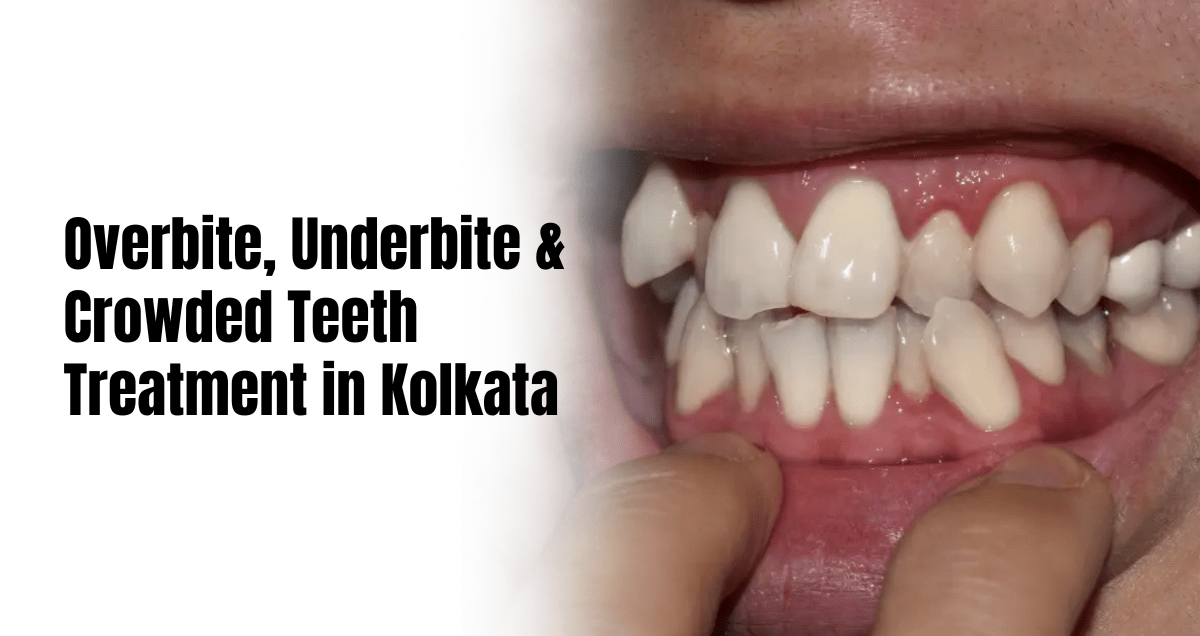 orthodontic solutions in kolkata