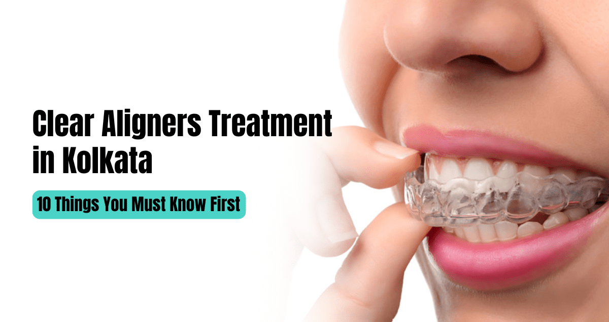 aligners treatment in kolkata