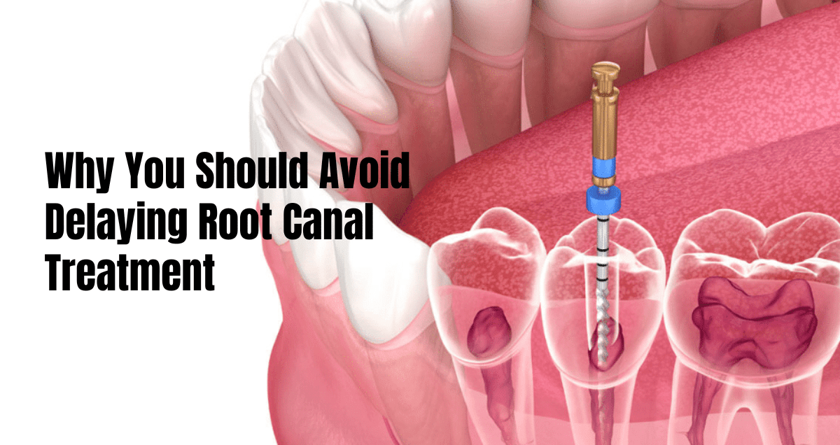 delaying root canal treatment in kolkata