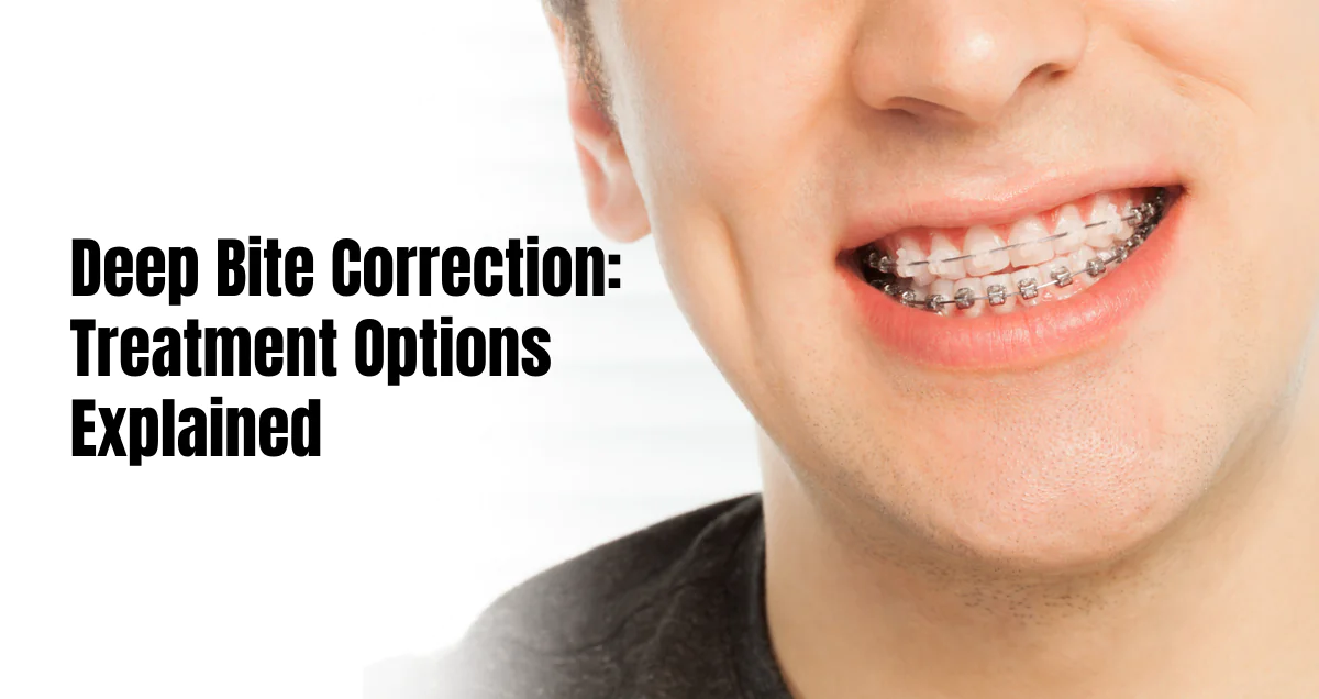 Deep bite correction