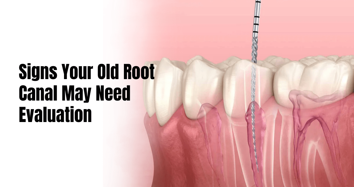 Root Canal Retreatment