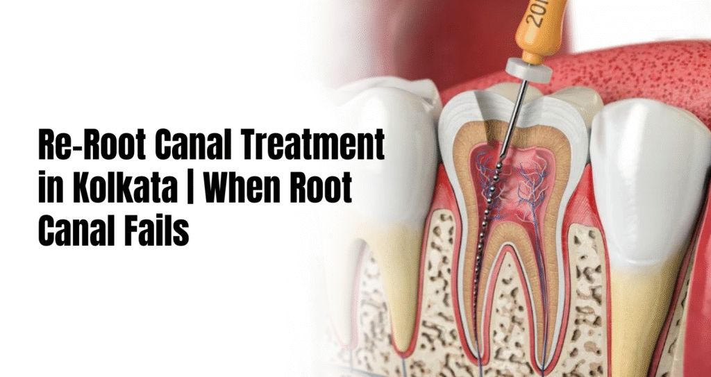 re root canal treatment