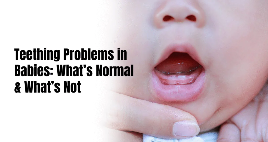 Teething problems in babies