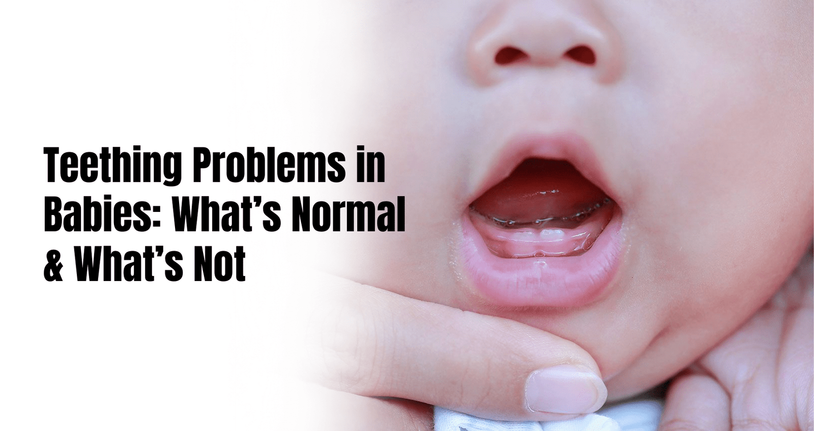 Teething problems in babies