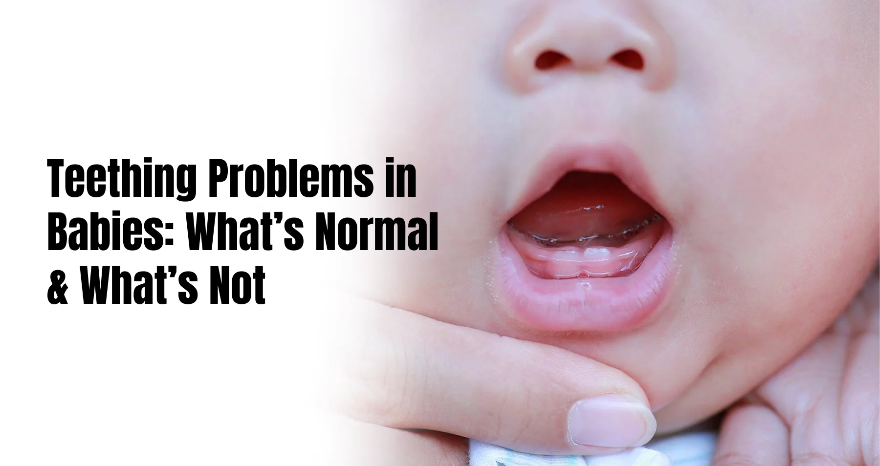 Teething problems in babies