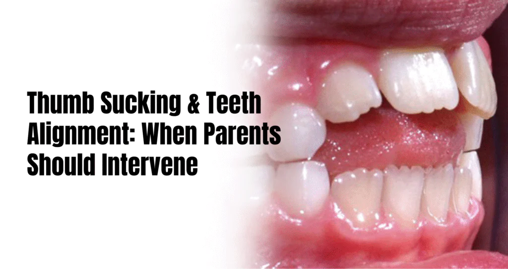 Thumb sucking and teeth alignment