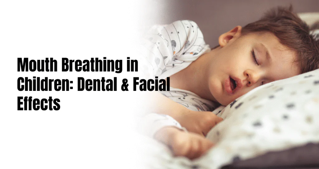 Mouth breathing in children