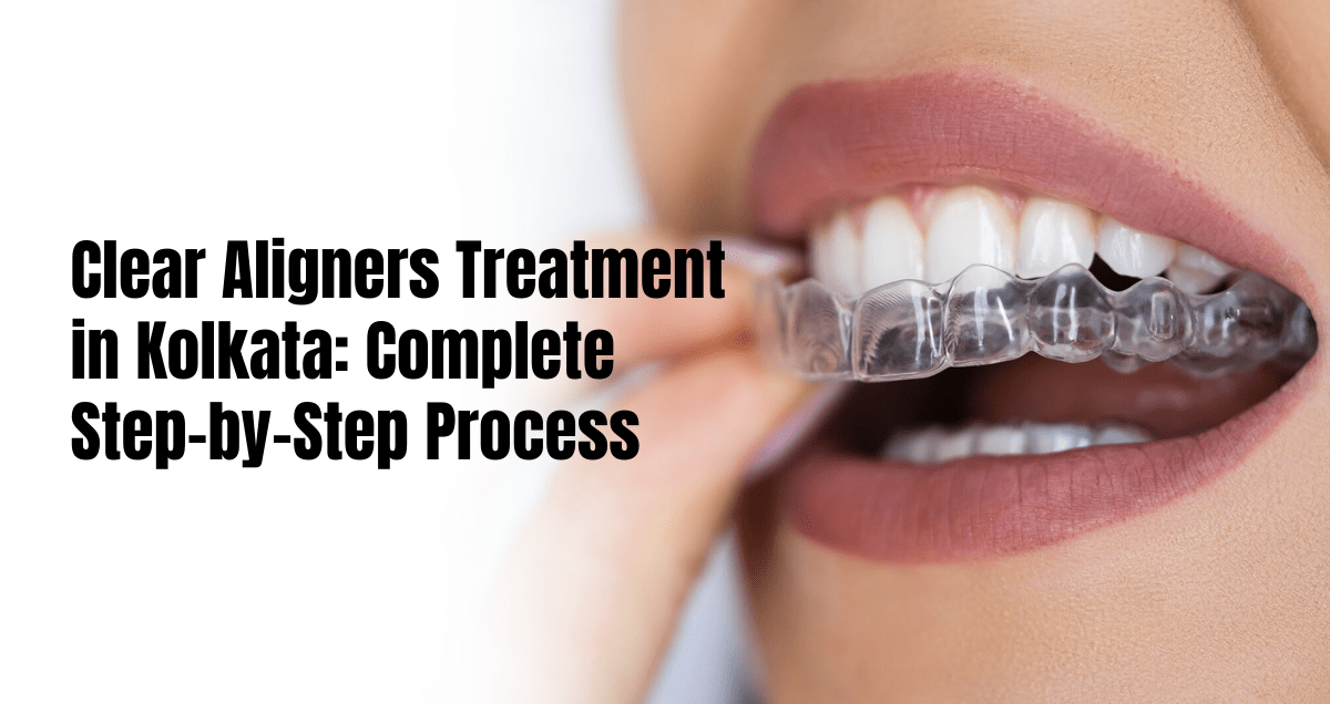 clear aligners treatment