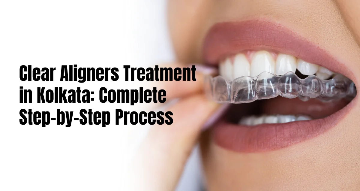clear aligners treatment