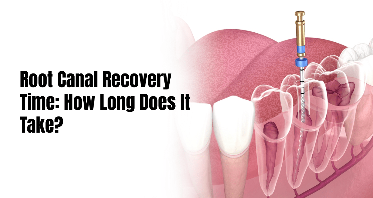 Root canal recovery time