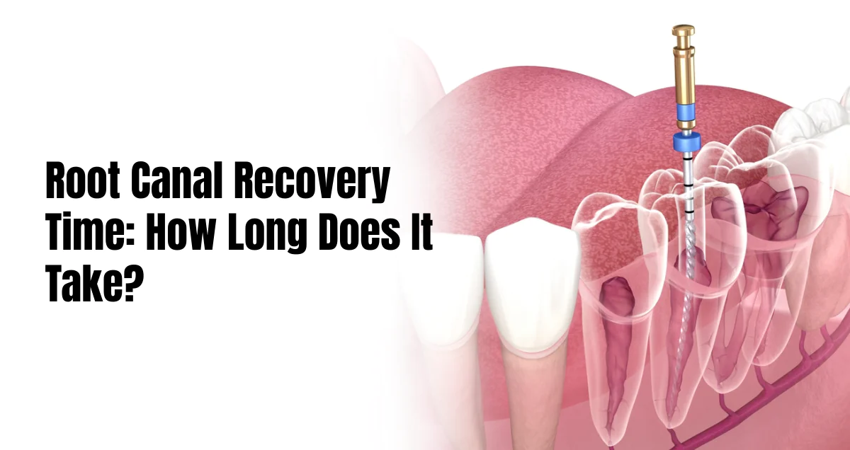 Root canal recovery time