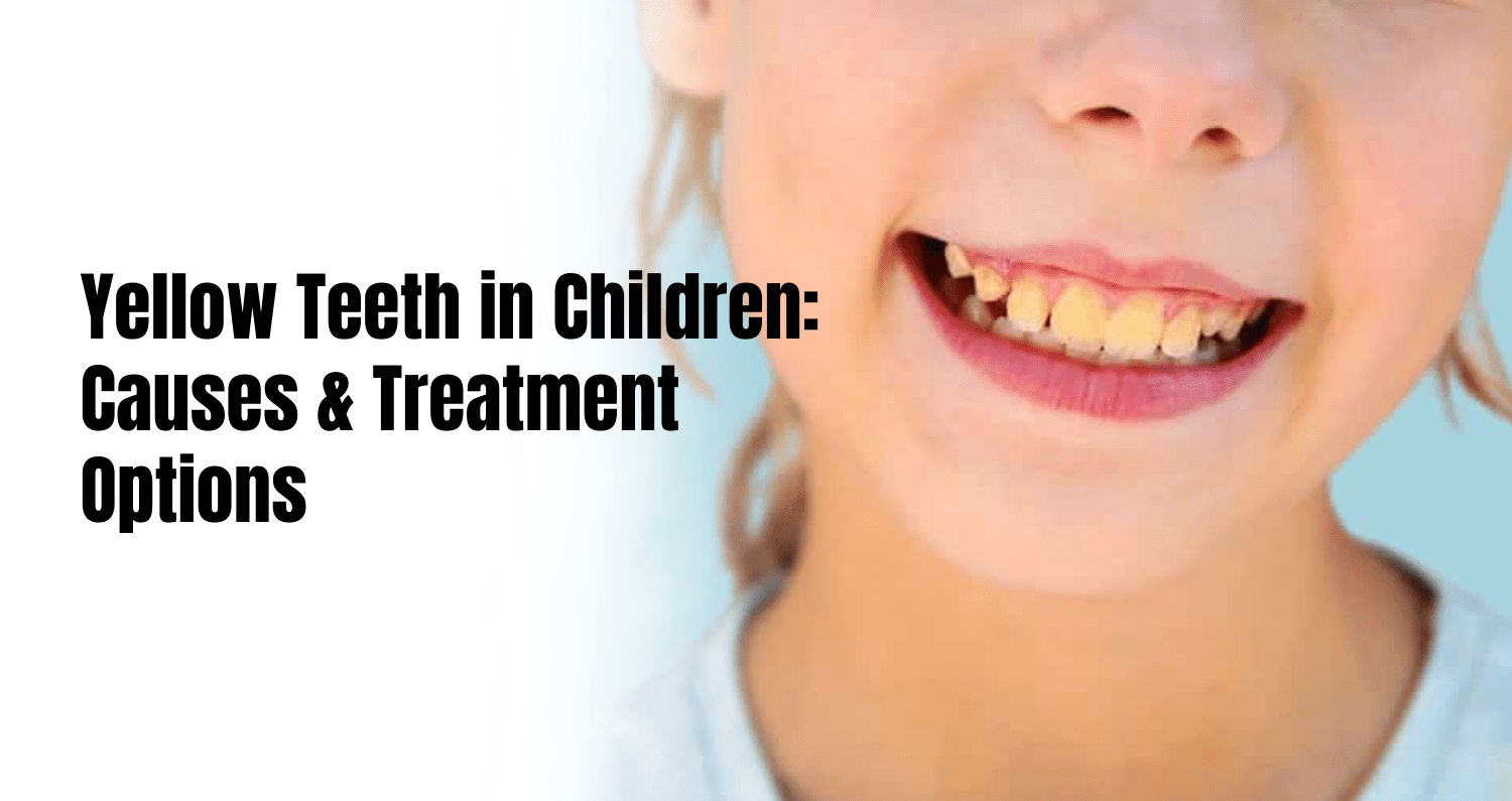 Yellow teeth in children