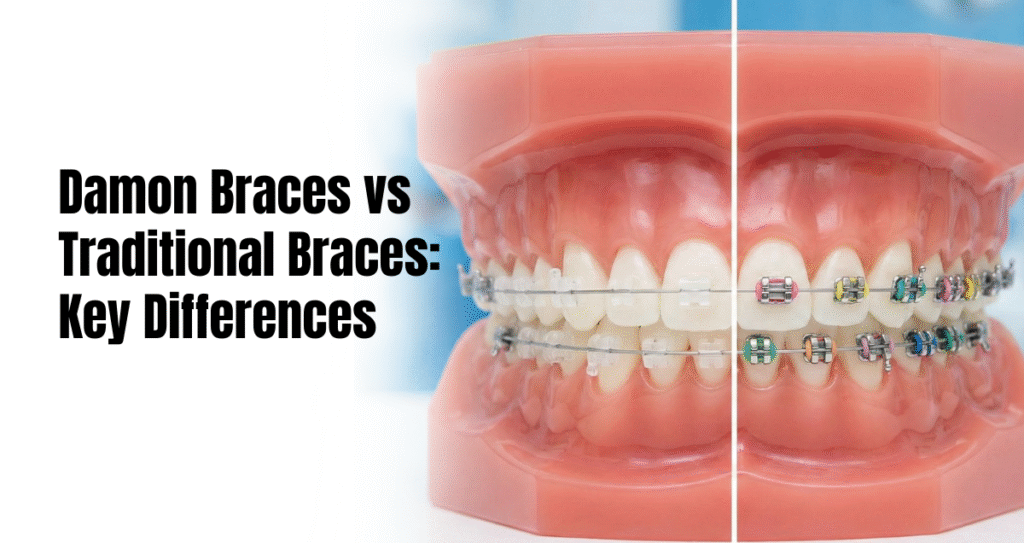 Damon Braces vs Traditional Braces