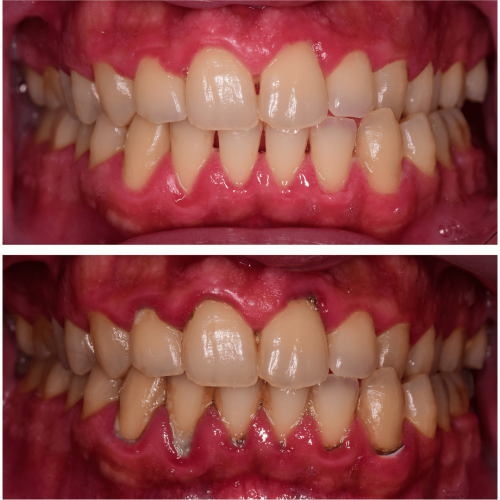 Before after (3) (1)