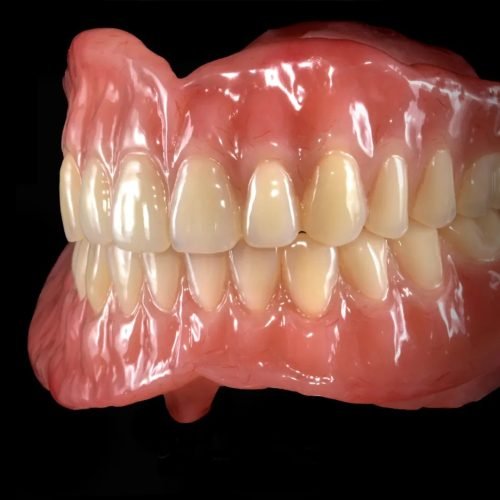 dentures in Kolkata