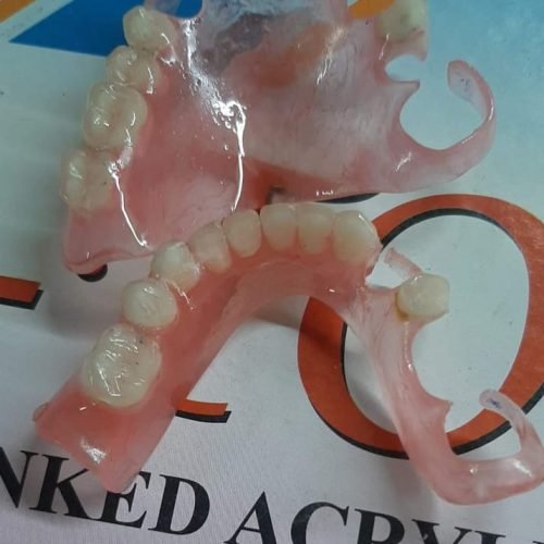 Denture Flexible (1)