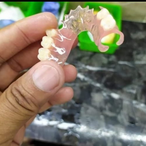 Denture Flexible (2)