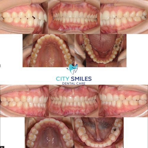 Ortho Sqaure 2
