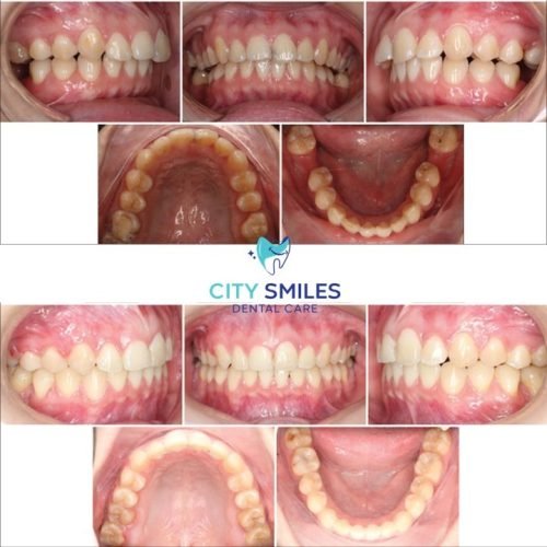 Ortho Sqaure 3