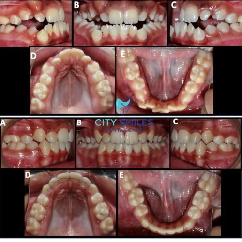 Ortho Square 1