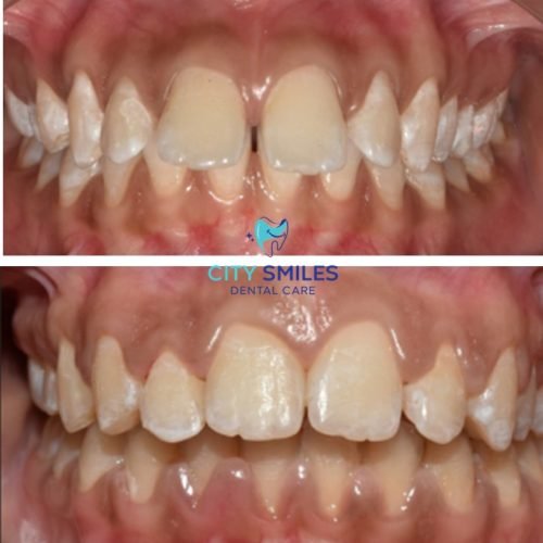 Ortho square 4