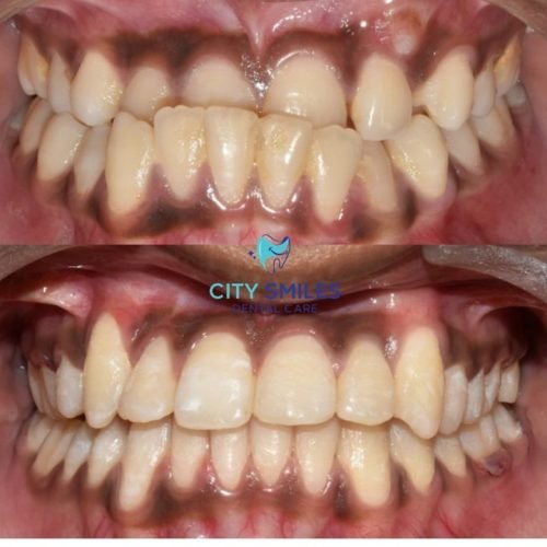 Ortho square 5