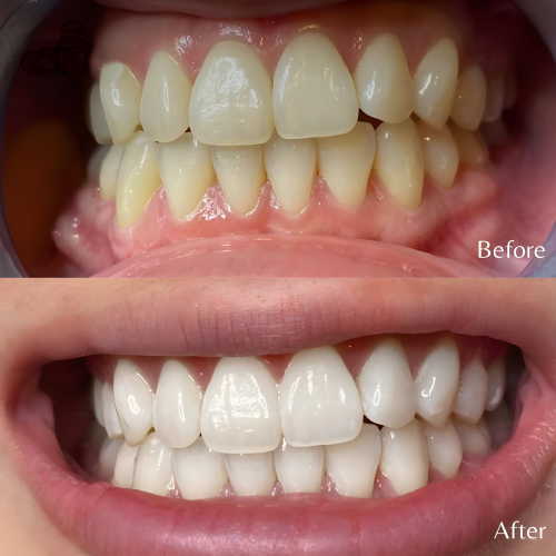 cosmetic dentistry in Kolkata