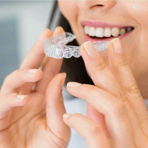 clear aligners Kolkata