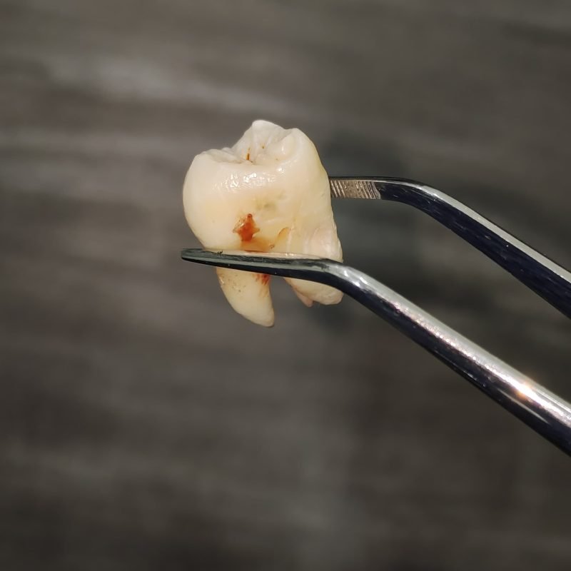 surgery 1